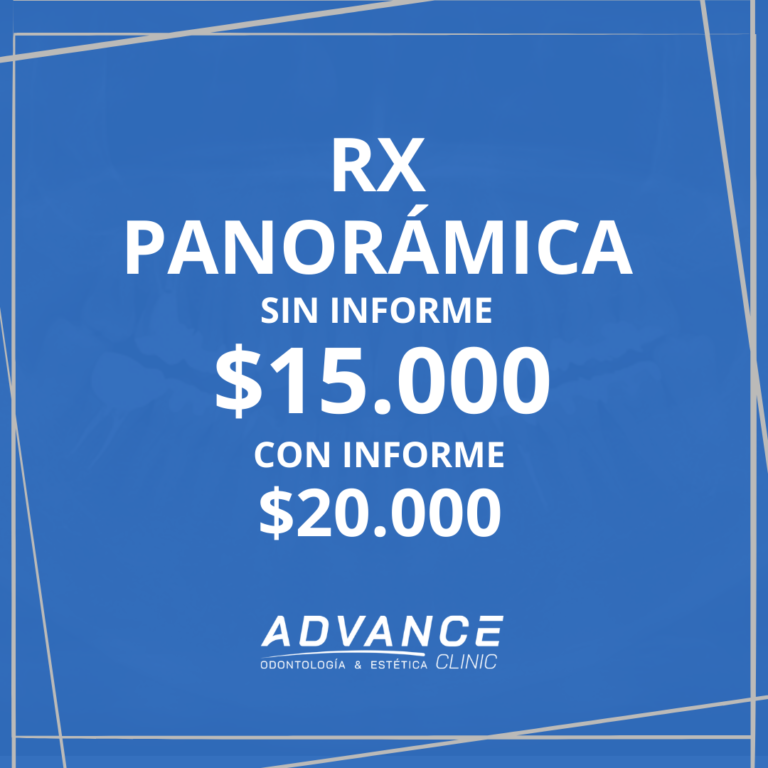 RX-PANORAMICA